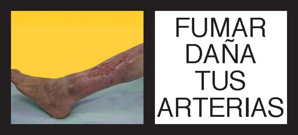 Advertencias sanitarias control tabaco